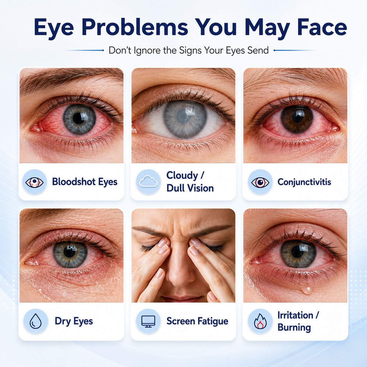 👁️ EELHOE Sterile Eye Drops – Preservative‑Free, Portable, Single‑Use Vials-QE