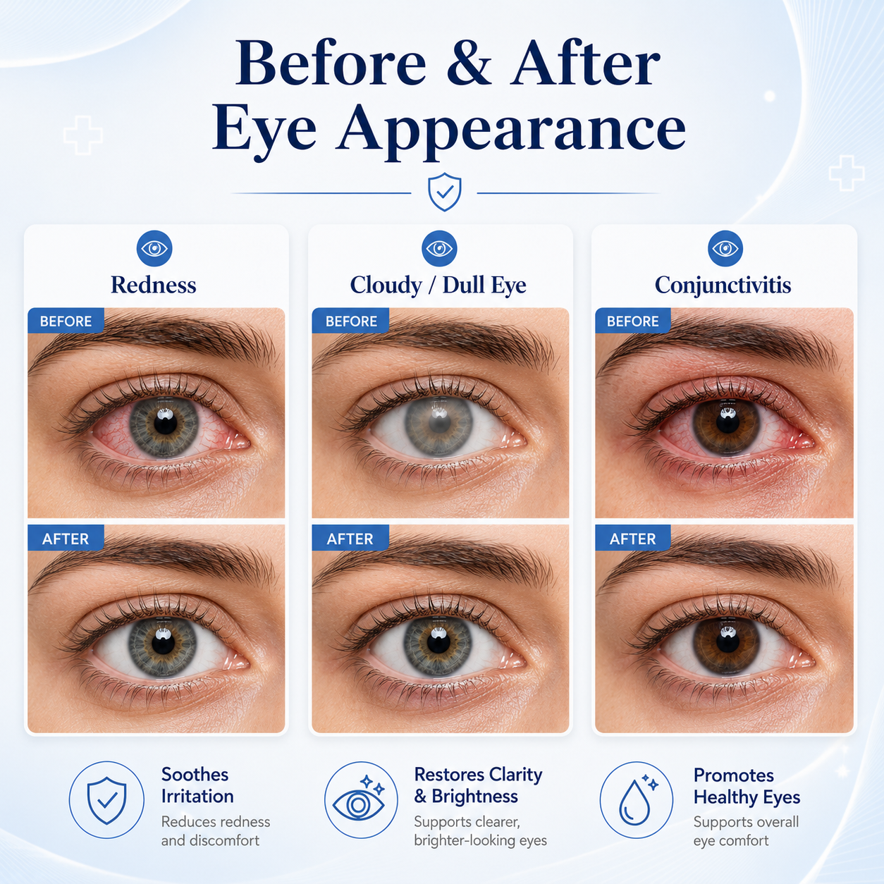 👁️ EELHOE Sterile Eye Drops – Preservative‑Free, Portable, Single‑Use Vials-QE