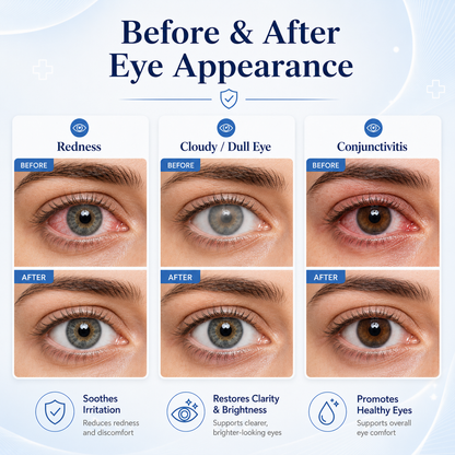 👁️ EELHOE Sterile Eye Drops – Preservative‑Free, Portable, Single‑Use Vials-QE